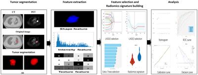 18F-FDG PET/CT radiomics nomogram for predicting occult lymph node metastasis of non-small cell lung cancer